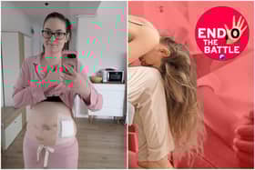 Laurene recently travelled to Bucharest in Romania to have surgery for endometriosis.