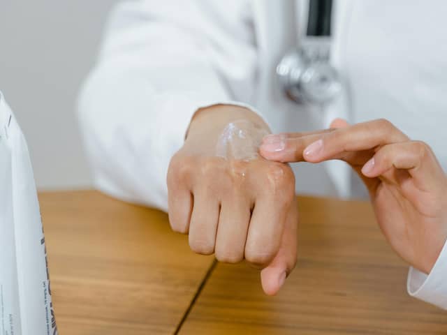 Children with this common skin condition may be more likely to suffer from hay fever later in life.