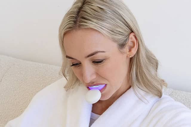 SmilePro customers reveal why this teeth whitening kit is their beauty must-have