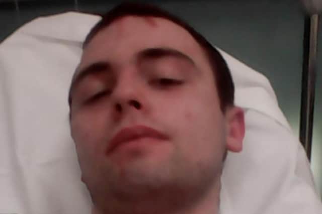 Sean Boyle takes a selfie from his bed during one of his many hospital stays due to his addiction problems. (Credit: Boyle family.)