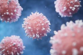 There are around 630 extra cancer deaths in Northern Ireland each year linked to socioeconomic inequality.